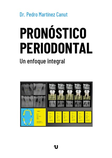 Portada del libro Pronóstico periodontal. Un enfoque integral