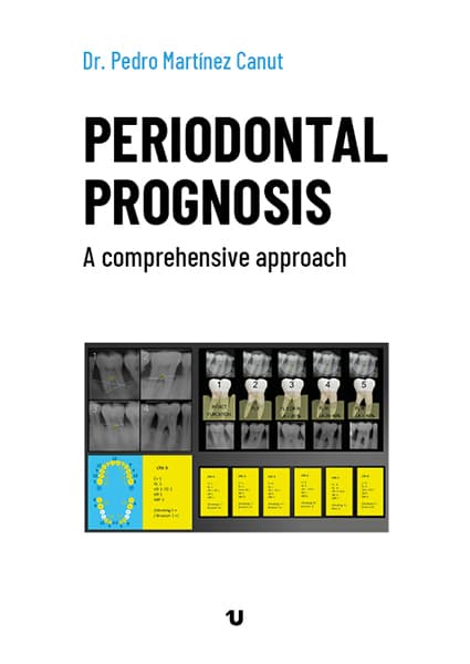 Portada del libro Periodontal prognosis. A comprehensive approach